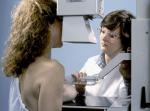 754. 011107. 28. Campaña de detección precoz del cáncer de mama.